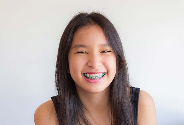 orthodontics-cabramatta